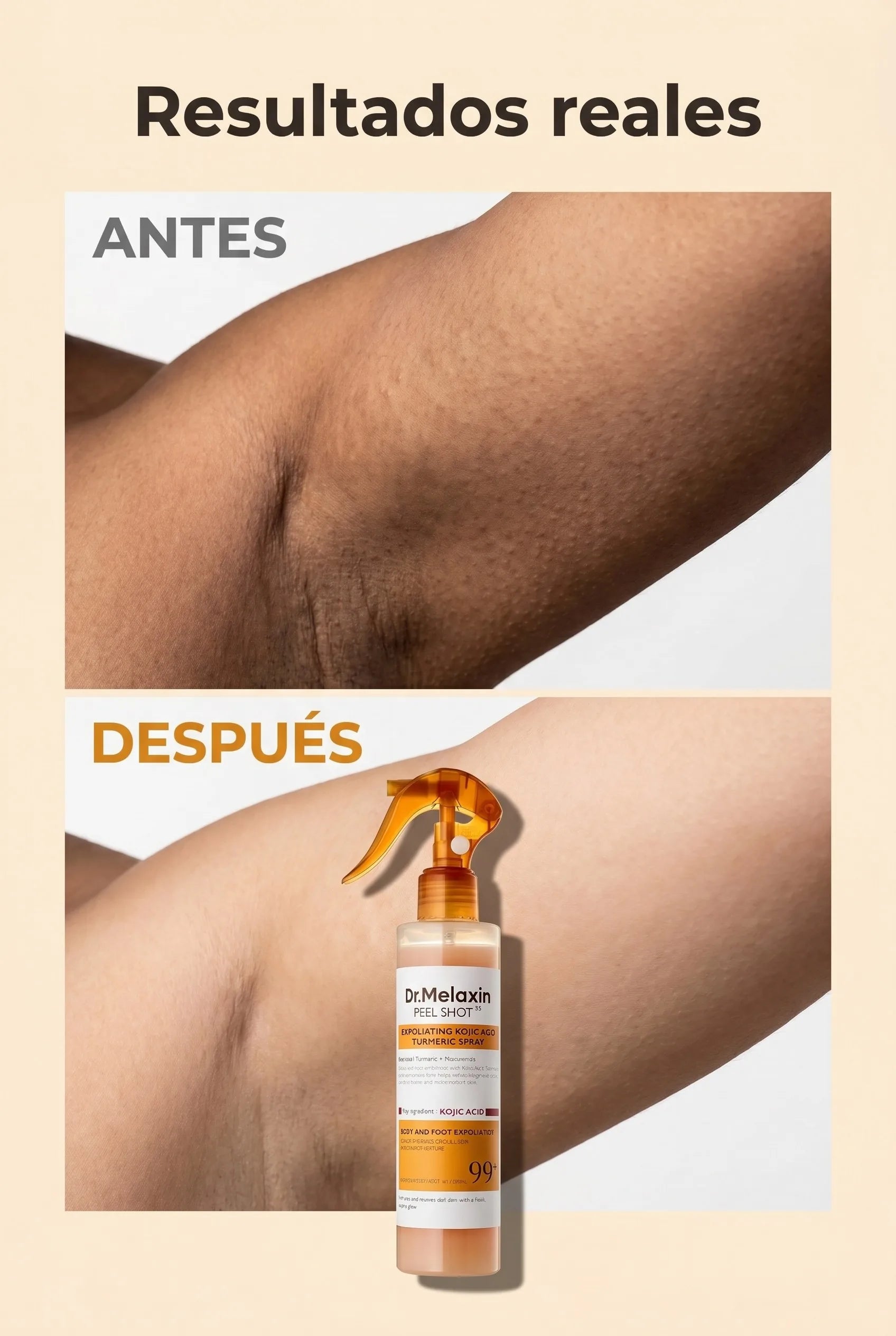 dr-melaxin-peel-shot 05_antes_despues